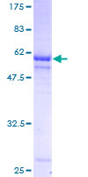 PIH1D1 Protein - 12.5% SDS-PAGE of human FLJ20643 stained with Coomassie Blue
