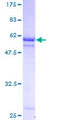 PIH1D1 Protein - 12.5% SDS-PAGE of human FLJ20643 stained with Coomassie Blue