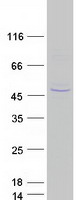 PIH1D2 Protein - Purified recombinant protein PIH1D2 was analyzed by SDS-PAGE gel and Coomassie Blue Staining
