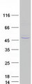 PIH1D2 Protein - Purified recombinant protein PIH1D2 was analyzed by SDS-PAGE gel and Coomassie Blue Staining