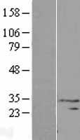 PIH1D3 Protein - Western validation with an anti-DDK antibody * L: Control HEK293 lysate R: Over-expression lysate