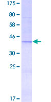 PIK3C2A Protein - 12.5% SDS-PAGE Stained with Coomassie Blue.