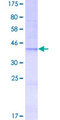 PIK3C2A Protein - 12.5% SDS-PAGE Stained with Coomassie Blue.