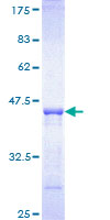 PIK3C2B Protein - 12.5% SDS-PAGE Stained with Coomassie Blue.
