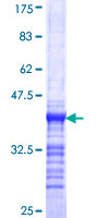 PIK3C2G Protein - 12.5% SDS-PAGE Stained with Coomassie Blue.