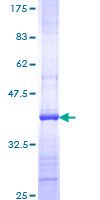 PIK3CA / PI3K Alpha Protein - 12.5% SDS-PAGE Stained with Coomassie Blue.