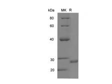 PIK3CA / PI3K Alpha Protein - Recombinant Human PIK3CA Protein (His Tag)-Elabscience