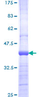 PIK3CB / PI3K Beta Protein - 12.5% SDS-PAGE Stained with Coomassie Blue.