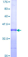 PIK3CD / PI3K Delta Protein - 12.5% SDS-PAGE Stained with Coomassie Blue.