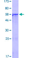 PIK3IP1 / HGFL Protein - 12.5% SDS-PAGE of human PIK3IP1 stained with Coomassie Blue