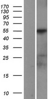 PIK3R1 / p85 Alpha Protein - Western validation with an anti-DDK antibody * L: Control HEK293 lysate R: Over-expression lysate