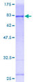 PIK3R1 / p85 Alpha Protein - 12.5% SDS-PAGE of human PIK3R1 stained with Coomassie Blue