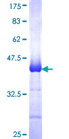 PIK3R1 / p85 Alpha Protein - 12.5% SDS-PAGE Stained with Coomassie Blue.