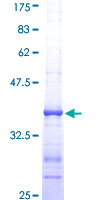 PIK3R4 Protein - 12.5% SDS-PAGE Stained with Coomassie Blue.