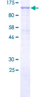 PIK3R6 Protein - 12.5% SDS-PAGE of human PIK3R6 stained with Coomassie Blue