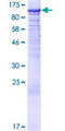 PIK4CB / PI4KB Protein - 12.5% SDS-PAGE of human PI4KB stained with Coomassie Blue
