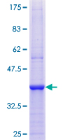 PIK4CB / PI4KB Protein - 12.5% SDS-PAGE Stained with Coomassie Blue.