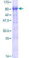PIKFYVE / PIP5K Protein - 12.5% SDS-PAGE of human PIP5K3 stained with Coomassie Blue