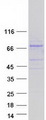 PIKFYVE / PIP5K Protein - Purified recombinant protein PIKFYVE was analyzed by SDS-PAGE gel and Coomassie Blue Staining