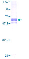 PIM1 / Pim-1 Protein - 12.5% SDS-PAGE of human PIM1 stained with Coomassie Blue