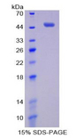 PIM1 / Pim-1 Protein - Recombinant Pim-1 Oncogene By SDS-PAGE