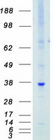 PIM1 / Pim-1 Protein - Purified recombinant protein PIM1 was analyzed by SDS-PAGE gel and Coomassie Blue Staining