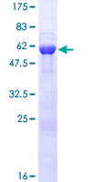 PIM2 / Pim-2 Protein - 12.5% SDS-PAGE of human PIM2 stained with Coomassie Blue