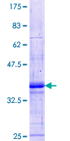 PIM3 / PIM-3 Protein - 12.5% SDS-PAGE Stained with Coomassie Blue.