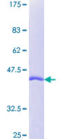 PIN1 Protein - 12.5% SDS-PAGE of human PIN1 stained with Coomassie Blue