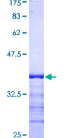 PIN1 Protein - 12.5% SDS-PAGE Stained with Coomassie Blue.