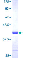 PIN4 Protein - 12.5% SDS-PAGE Stained with Coomassie Blue.