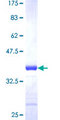 PIN4 Protein - 12.5% SDS-PAGE Stained with Coomassie Blue.