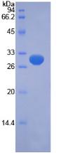 PINK1 Protein - Recombinant PTEN Induced Putative Kinase 1 By SDS-PAGE