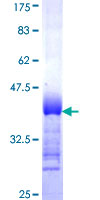 PINX1 Protein - 12.5% SDS-PAGE Stained with Coomassie Blue.