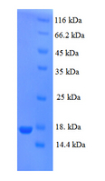 PIP / GCDFP-15 Protein
