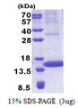 PIP / GCDFP-15 Protein