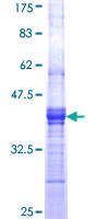 PIP4K2A / PIPK Protein - 12.5% SDS-PAGE Stained with Coomassie Blue.