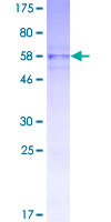 PIP4K2B Protein - 12.5% SDS-PAGE of human PIP5K2B stained with Coomassie Blue