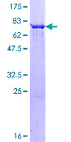 PIP4K2C Protein - 12.5% SDS-PAGE of human PIP4K2C stained with Coomassie Blue
