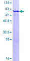 PIP4K2C Protein - 12.5% SDS-PAGE of human PIP4K2C stained with Coomassie Blue