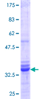 PIP4K2C Protein - 12.5% SDS-PAGE Stained with Coomassie Blue.