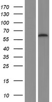 PIP5K1A Protein - Western validation with an anti-DDK antibody * L: Control HEK293 lysate R: Over-expression lysate