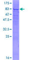PIP5K1A Protein - 12.5% SDS-PAGE of human PIP5K1A stained with Coomassie Blue