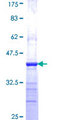 PIP5K1A Protein - 12.5% SDS-PAGE Stained with Coomassie Blue.