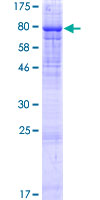 PIP5K1B Protein - 12.5% SDS-PAGE of human PIP5K1B stained with Coomassie Blue