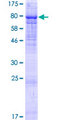 PIP5K1B Protein - 12.5% SDS-PAGE of human PIP5K1B stained with Coomassie Blue