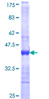 PIP5K1B Protein - 12.5% SDS-PAGE Stained with Coomassie Blue.