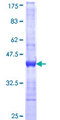 PIP5K1B Protein - 12.5% SDS-PAGE Stained with Coomassie Blue.
