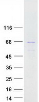 PIP5K1B Protein - Purified recombinant protein PIP5K1B was analyzed by SDS-PAGE gel and Coomassie Blue Staining