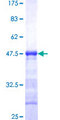 PIP5K1C Protein - 12.5% SDS-PAGE Stained with Coomassie Blue.